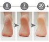 FeetCleanse™ | Alltid mjuka fötter